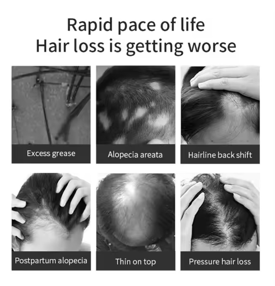 Rosemary Hair Oil Regrowth Serum